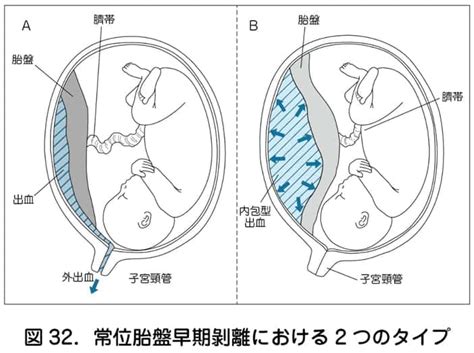 胎盤|胎盤の基礎｜完成時期や役割・妊娠中の胎盤トラブル 